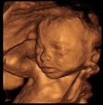 Imagen de ecografía de bebé