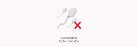 Qué es la infertilidad por factor masculino