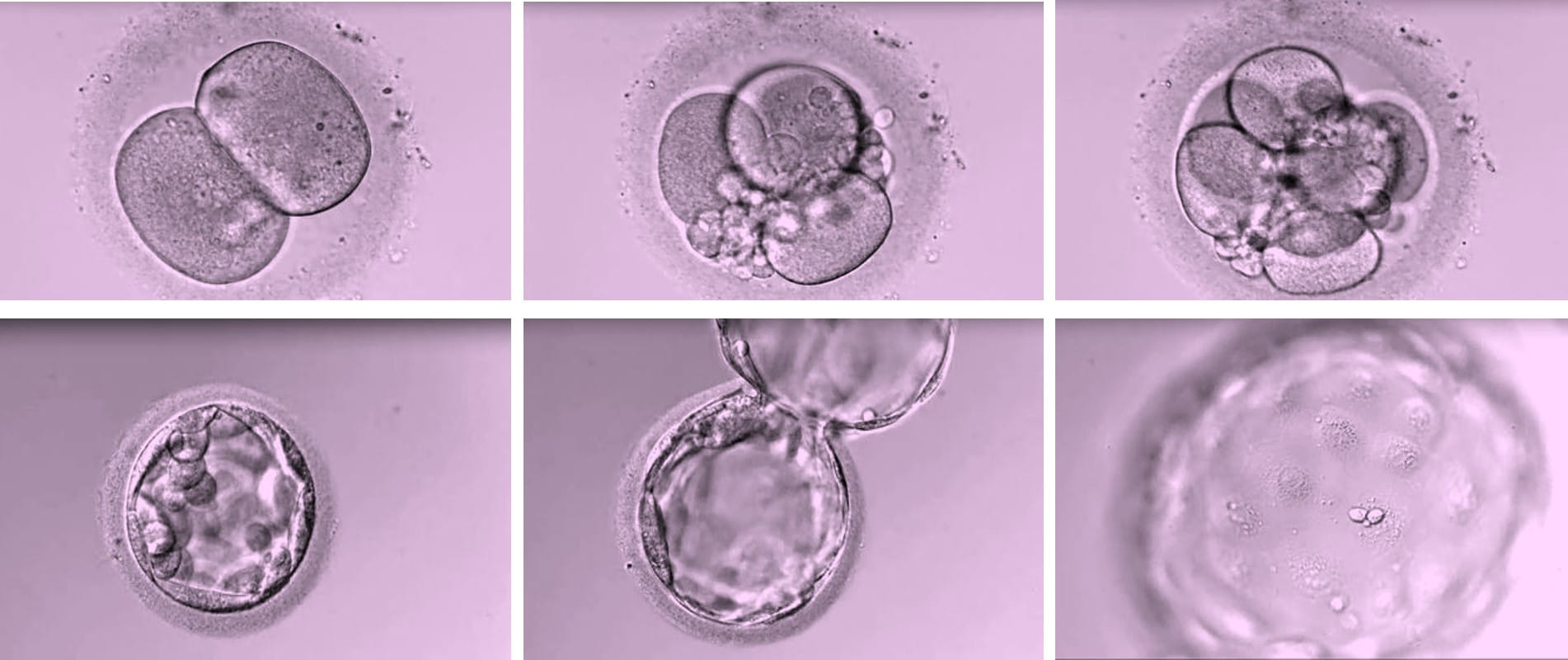 Embriones en Ginemed