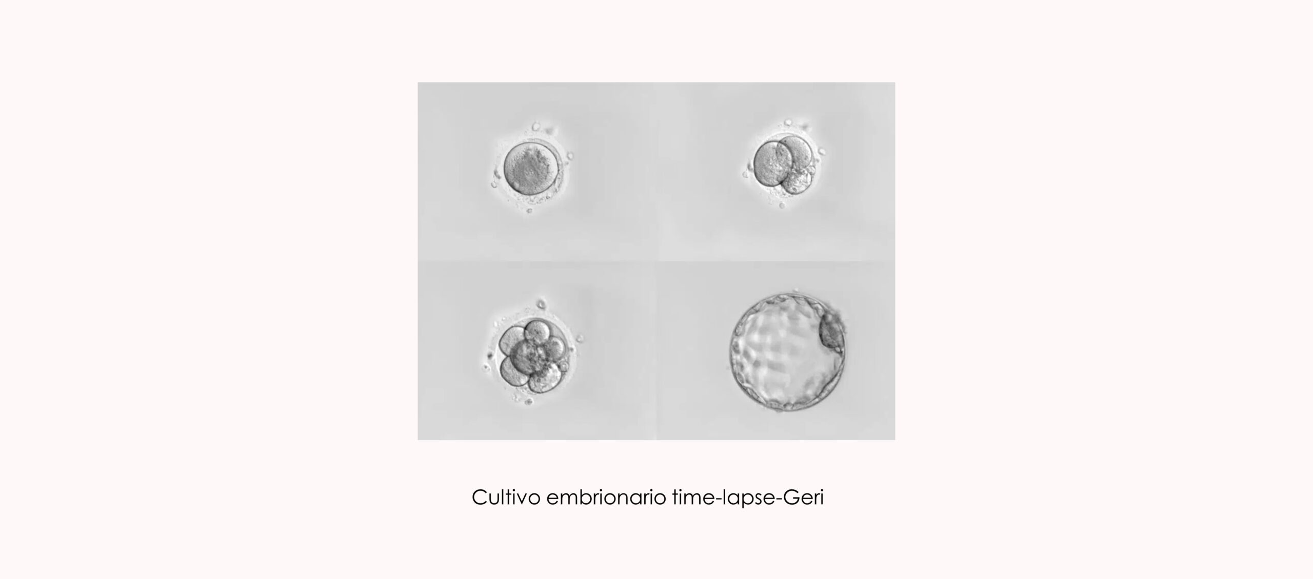 Cultivo embrionario time lapse Geri