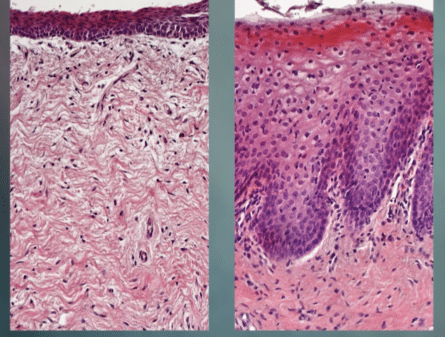 regeneración de tejido vaginal sin hormonas.