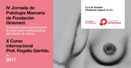 Cartel IV Jornada de patología mamaria de fundación ginemed. Encuentro internacional sobre el tratamiento multidisciplinar del cáncer de mama