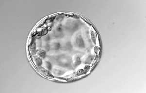implantación embrionaria