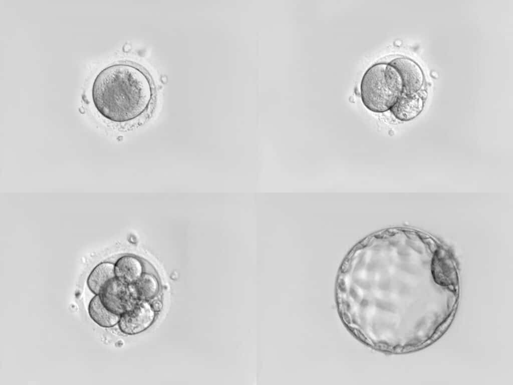 Cultivo embriones