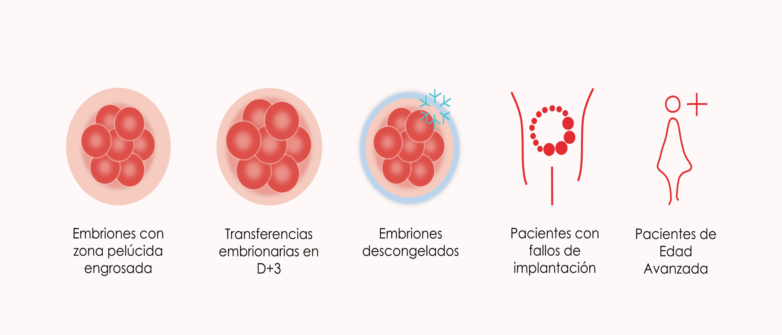 Qué es el hatching asistido y cuándo está indicado