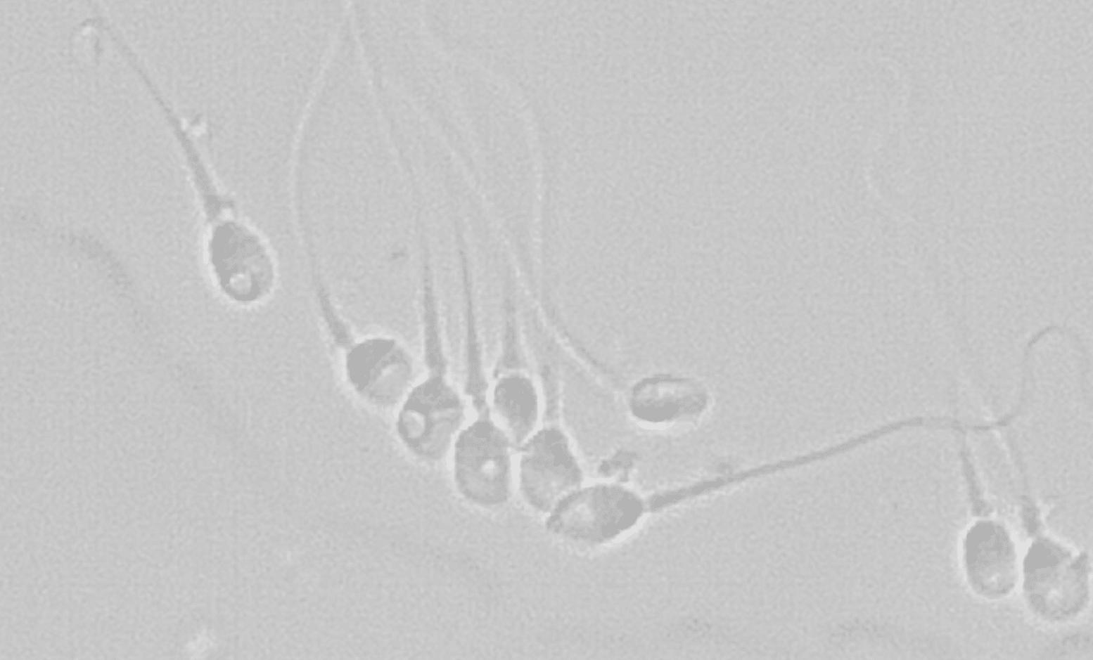 Imagen de microscopio de técnica IMSI