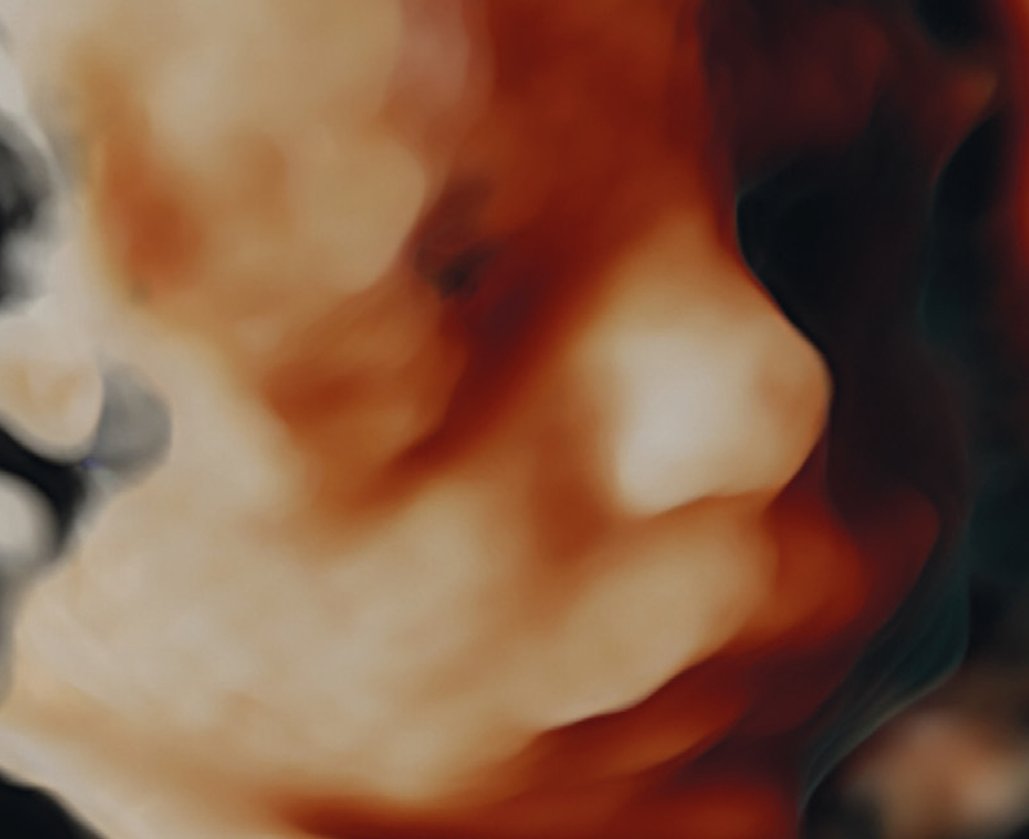 Unidad Medicina Fetal El feto como paciente