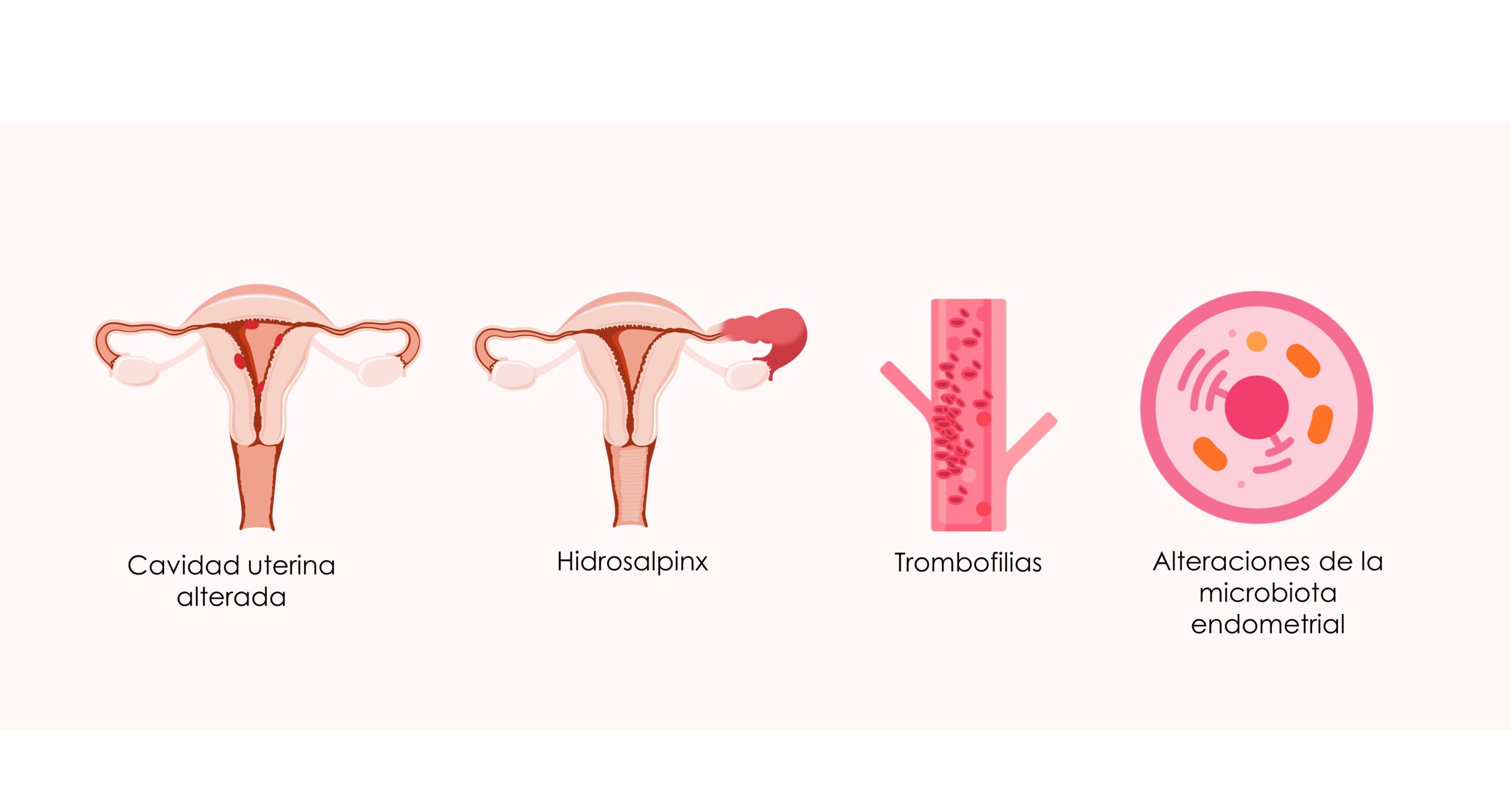 Riesgos de la baja receptividad endometrial