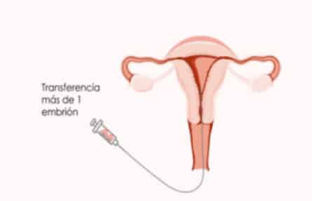 Transferencia embriones