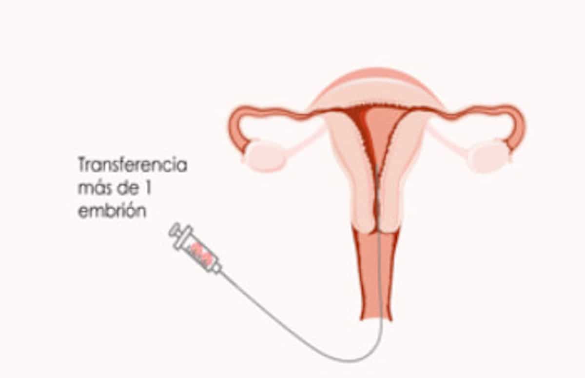 Transferencia embriones