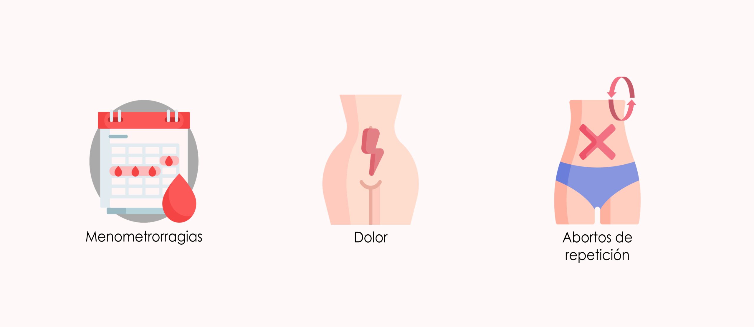 Miomas uterinos y fertilidad femenina 