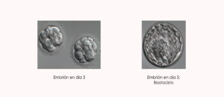 embrión-blastocisto