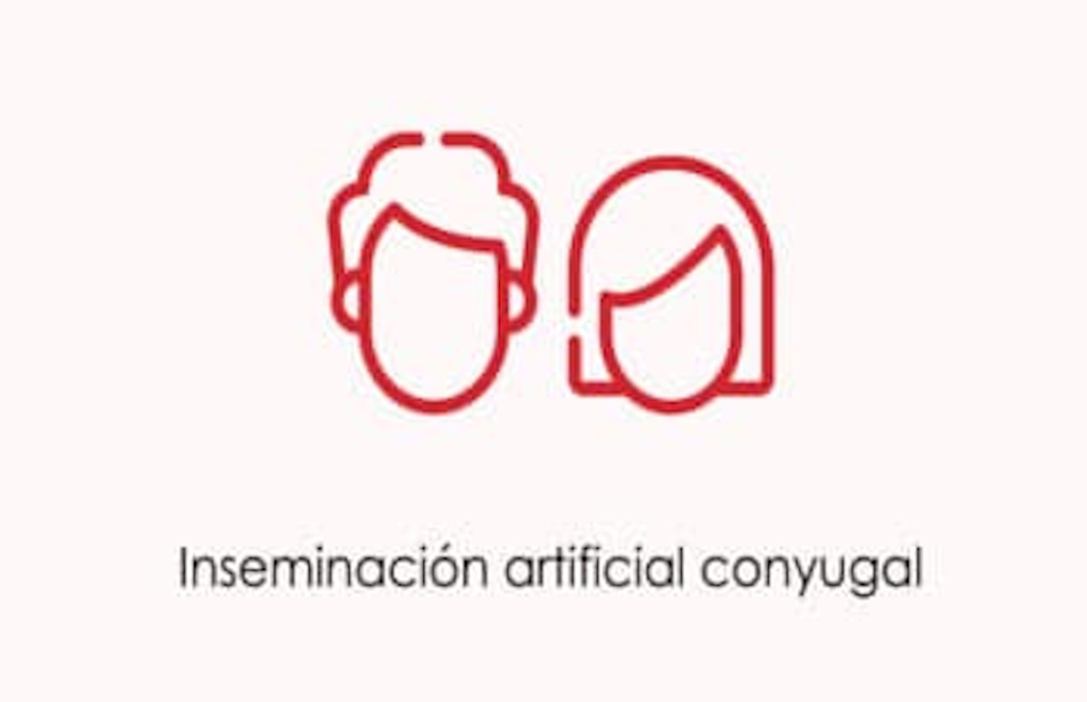 ¿Como es el tratamiento de la Inseminación Artificial Conyugal (IAC)?