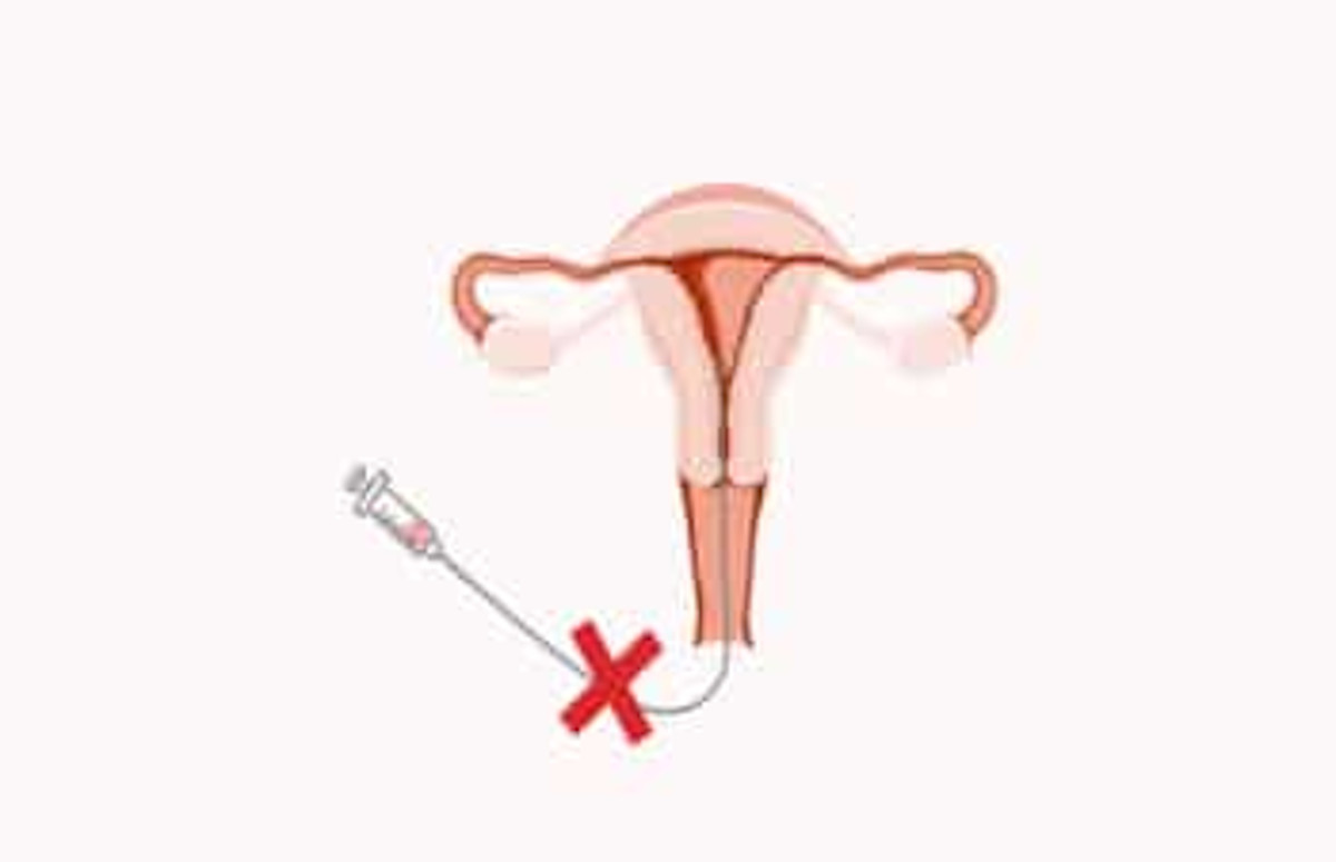¿Cuáles son los motivos para cancelar una fecundación in vitro?