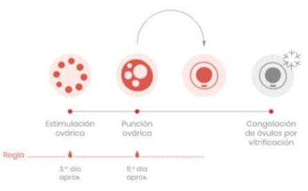 Proceso Preservación Óvulos