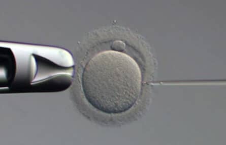 ¿Es mejor FIV convencional o FIV-ICSI?