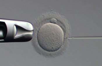 ¿Es mejor FIV convencional o FIV-ICSI?