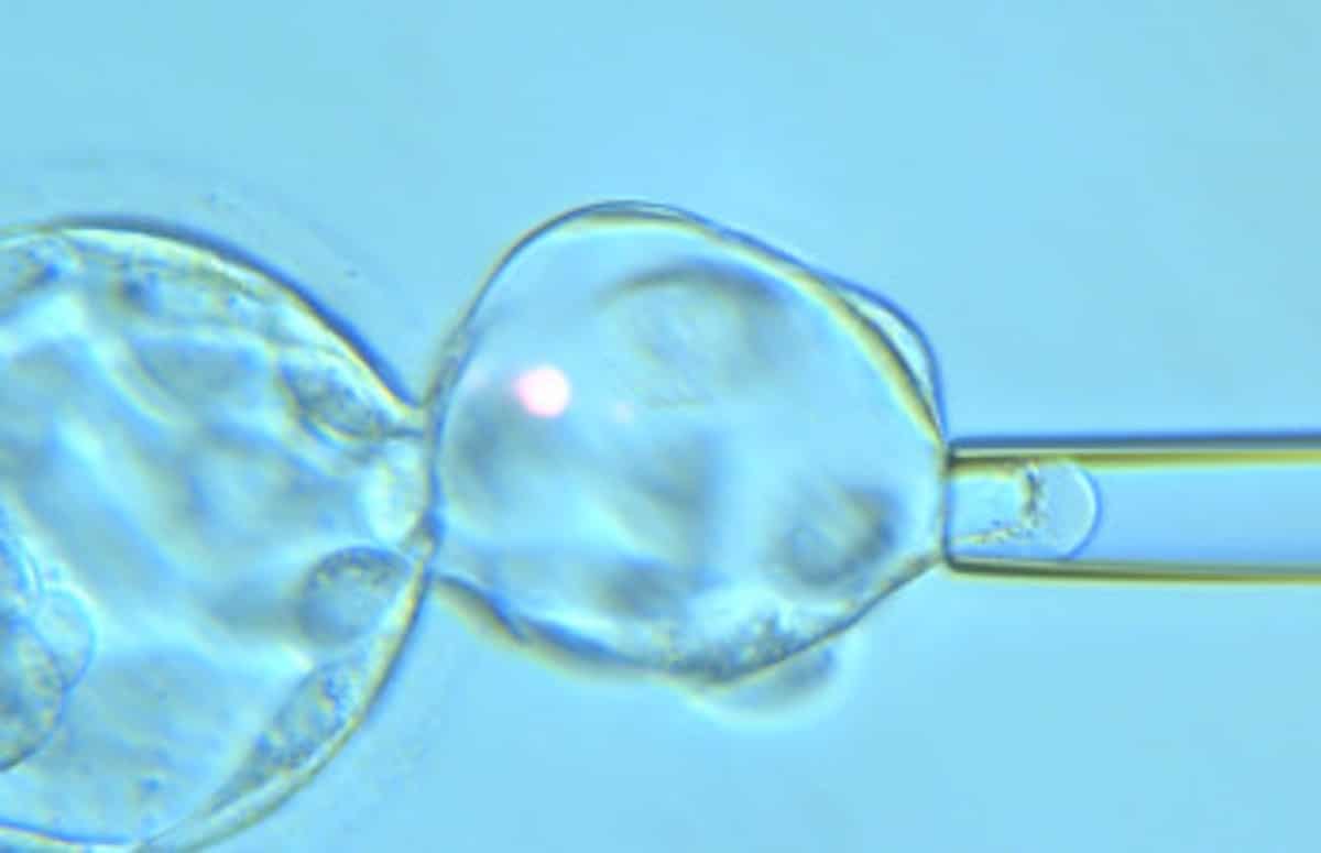 El PGT permite transferir embriones no afectos de hemofilia al útero materno
