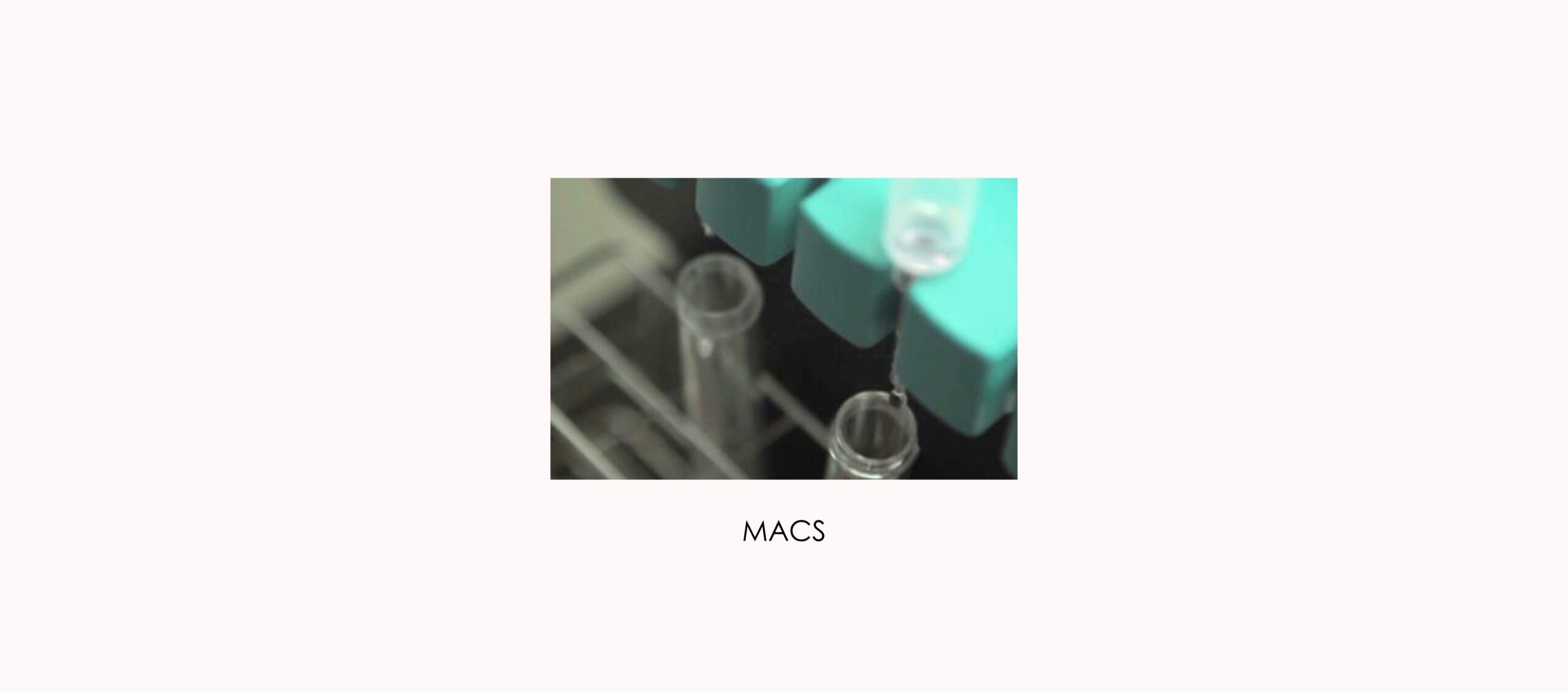 Técnica de selección espermática MACS