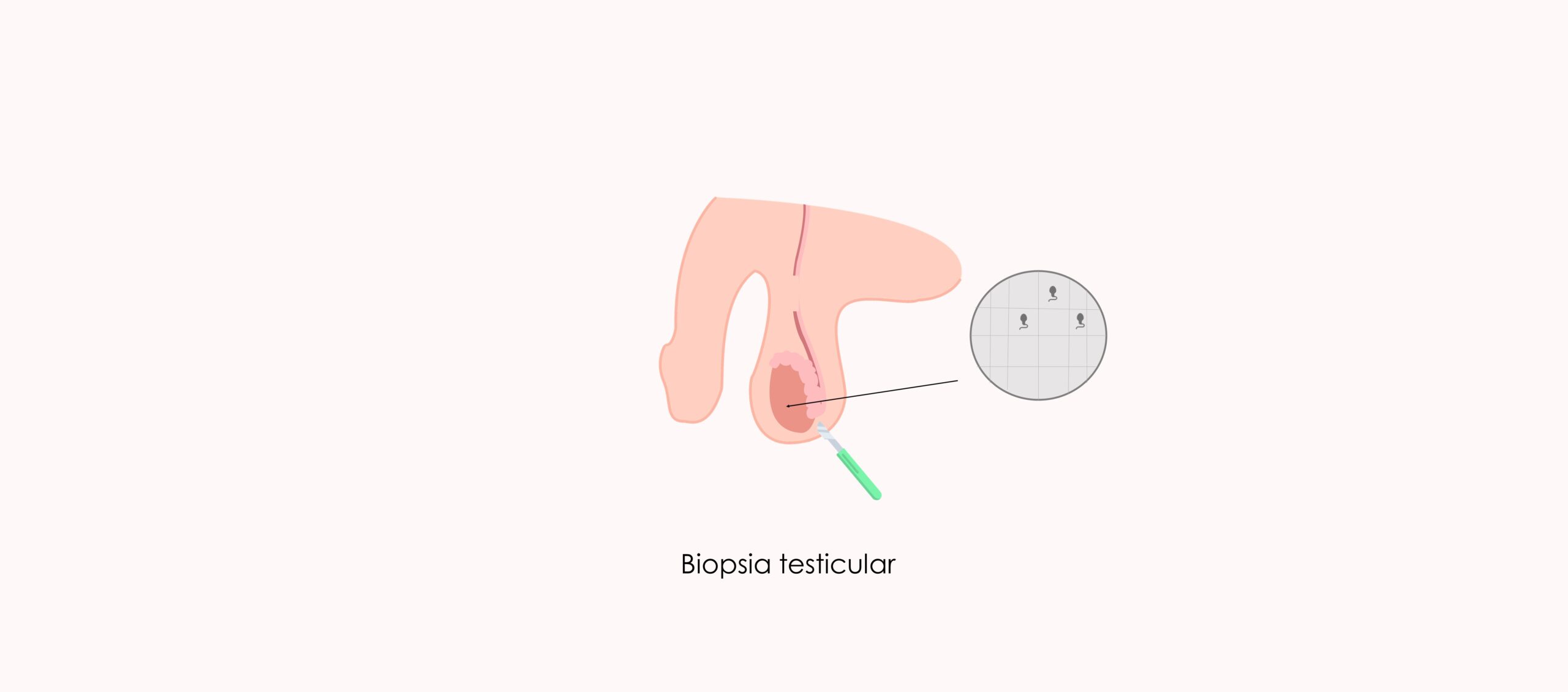 Biopsia testicular