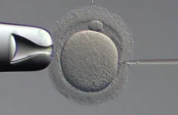 Tratamientos de reproducción asistida para conseguir el embarazo