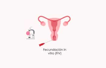 ¿Cuáles son las etapas del proceso de la Fecundación in vitro (FIV)?