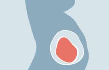 ¿Cuáles son las diferencias entre la ovodonación y la embrioadopción?