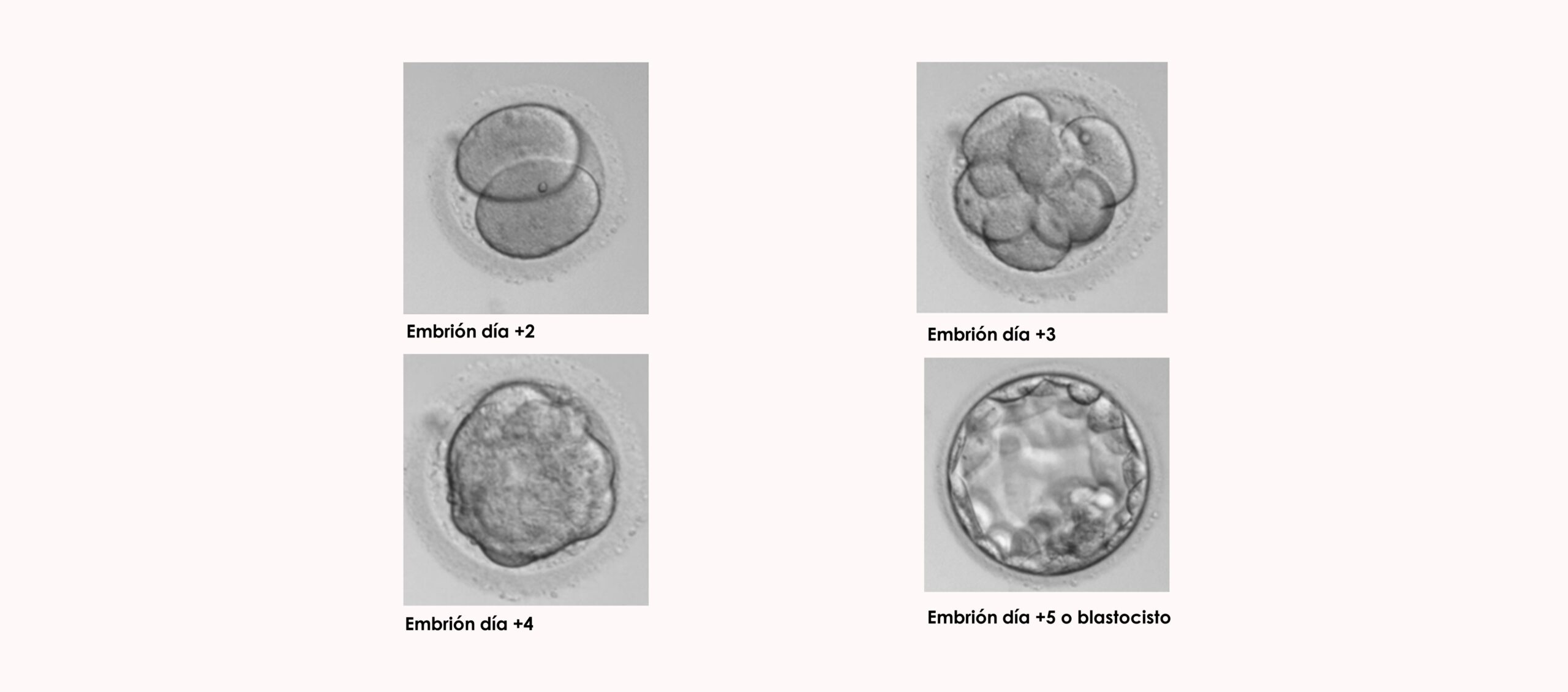 Clasificación embrionaria según día de desarrollo