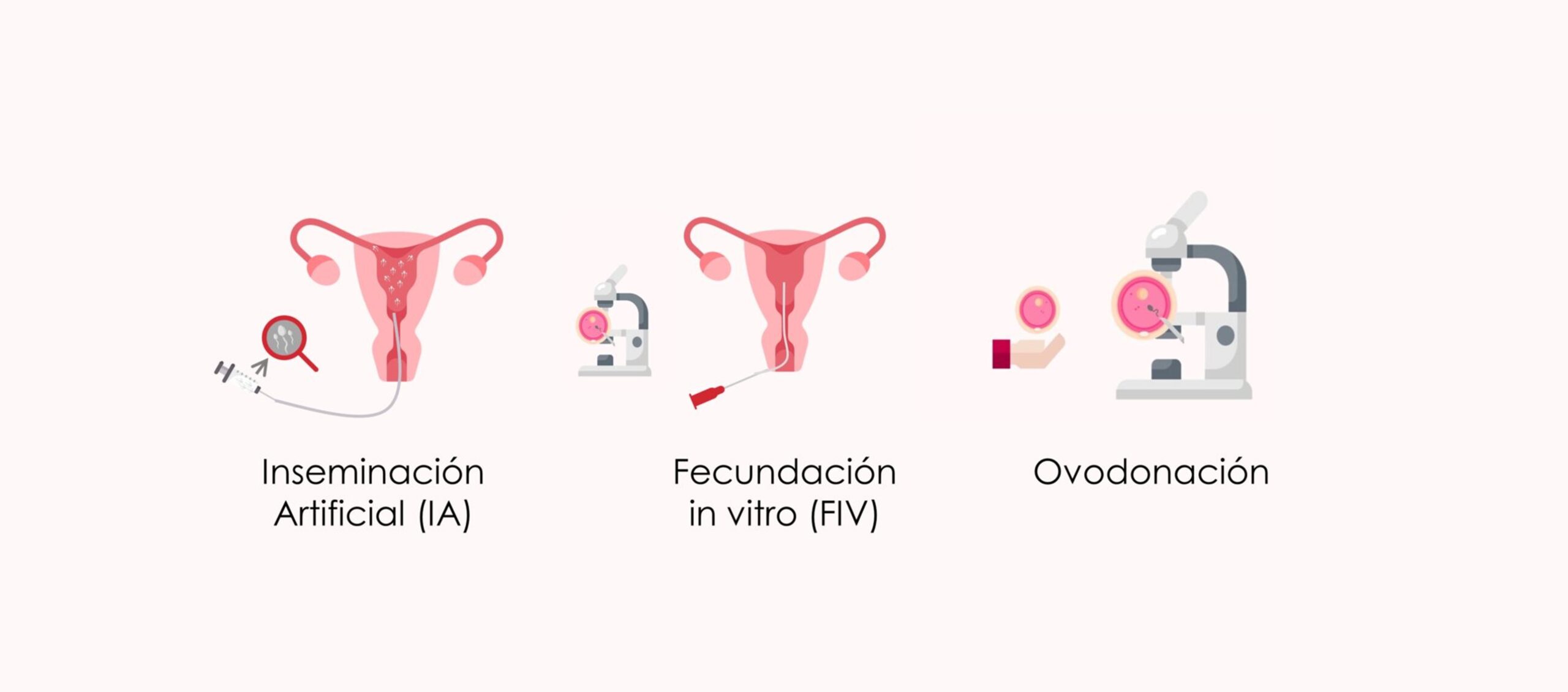 Tratamientos de reproducción asistida para quedar embarazada si los quistes ováricos afectan nuestra fertilidad