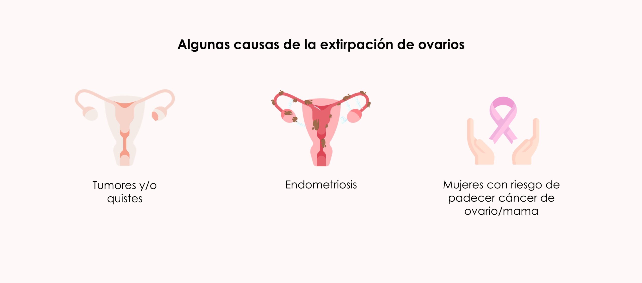 Algunas causas de la extirpación de ovarios (ooforectomía)