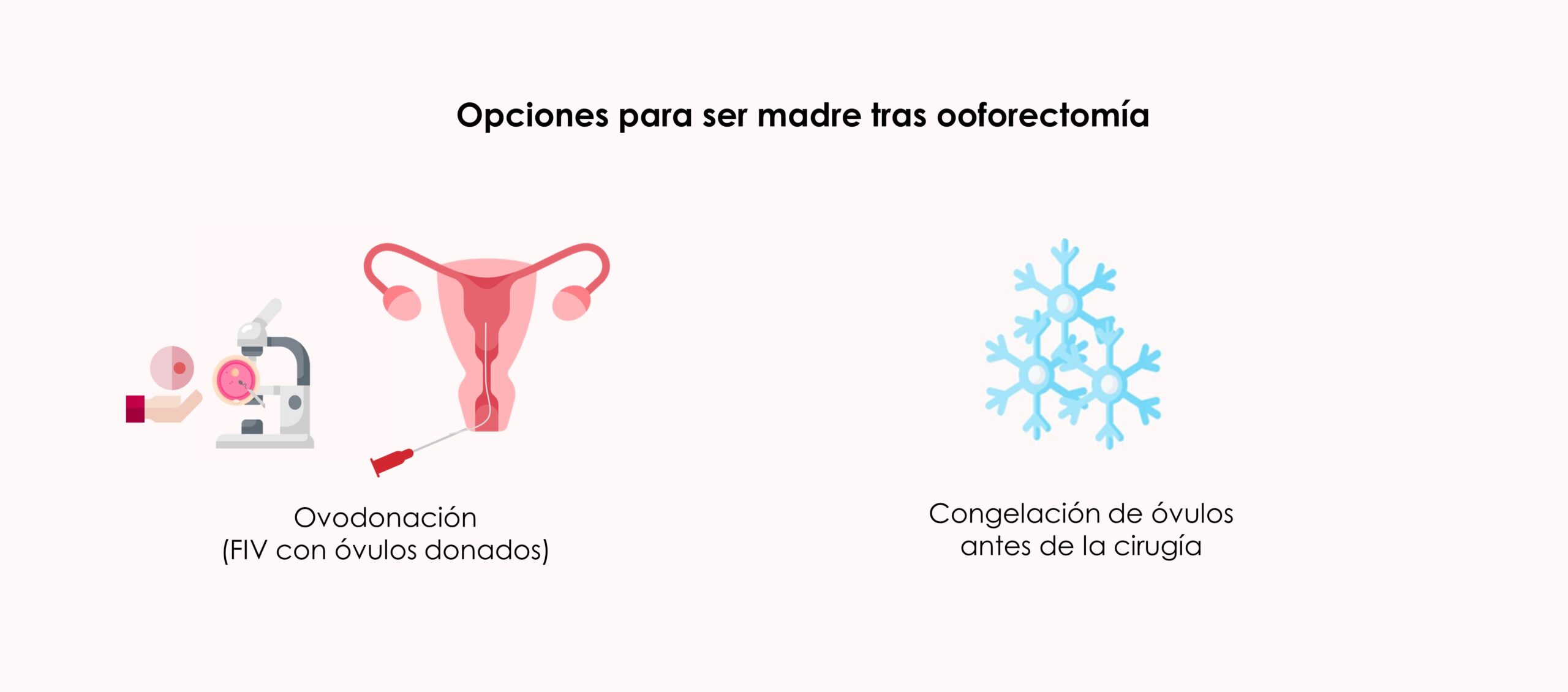 Opciones para ser madre tras ooforectomía