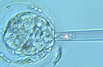 Proceso del test genético preimplantacional, ¿qué ventajas ofrece?