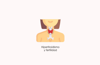 ¿Afecta el hipertiroidismo a la Fertilidad Femenina y Masculina?
