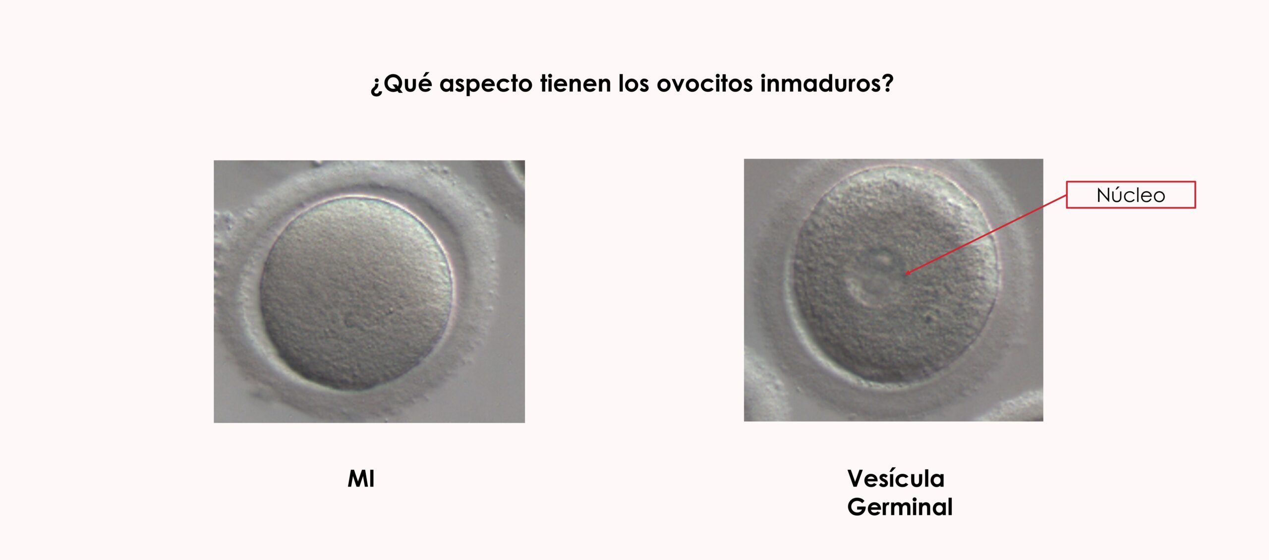 ¿Qué aspecto tienen los ovocitos inmaduros?