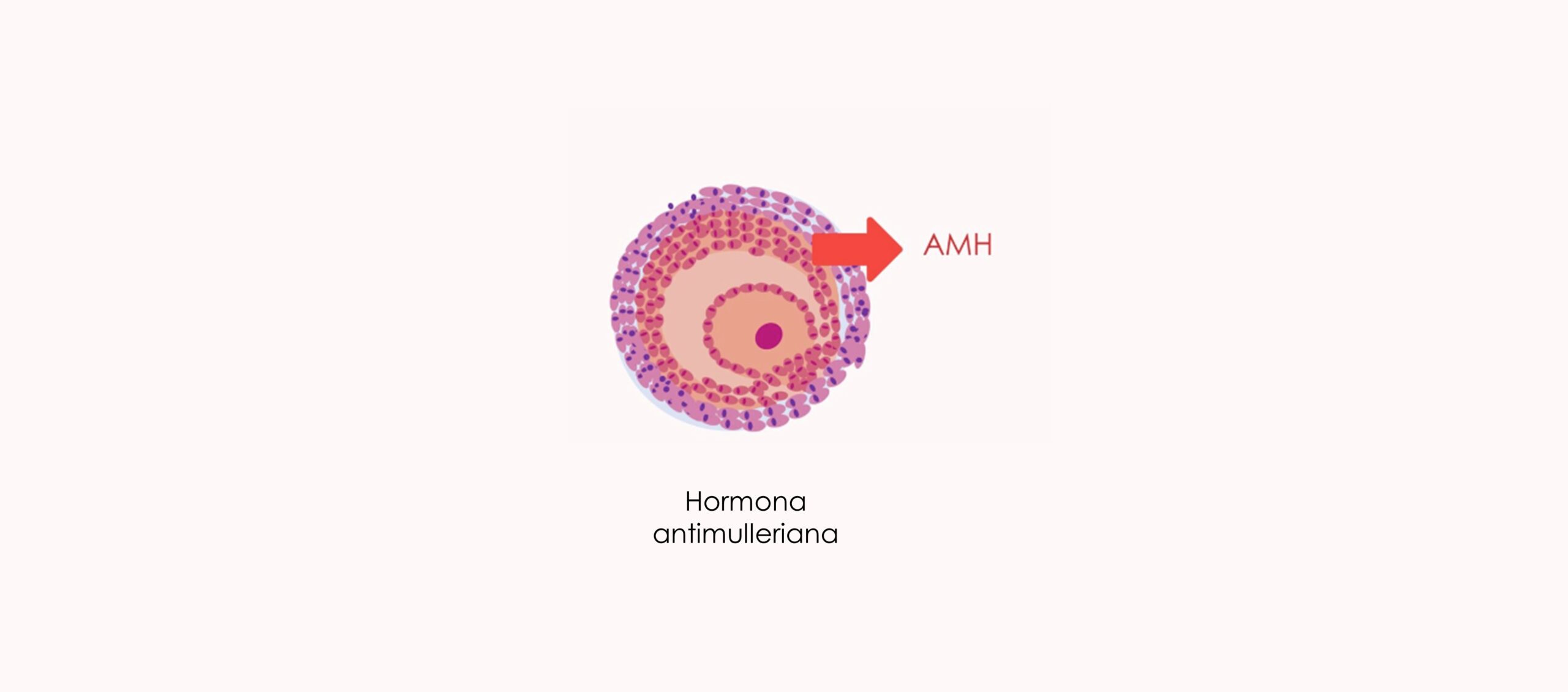 Hormona antimulleriana para medir la reserva ovárica