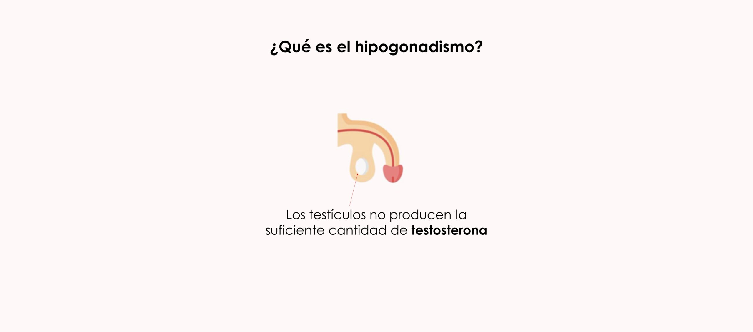 ¿En qué consiste el hipogonadismo?