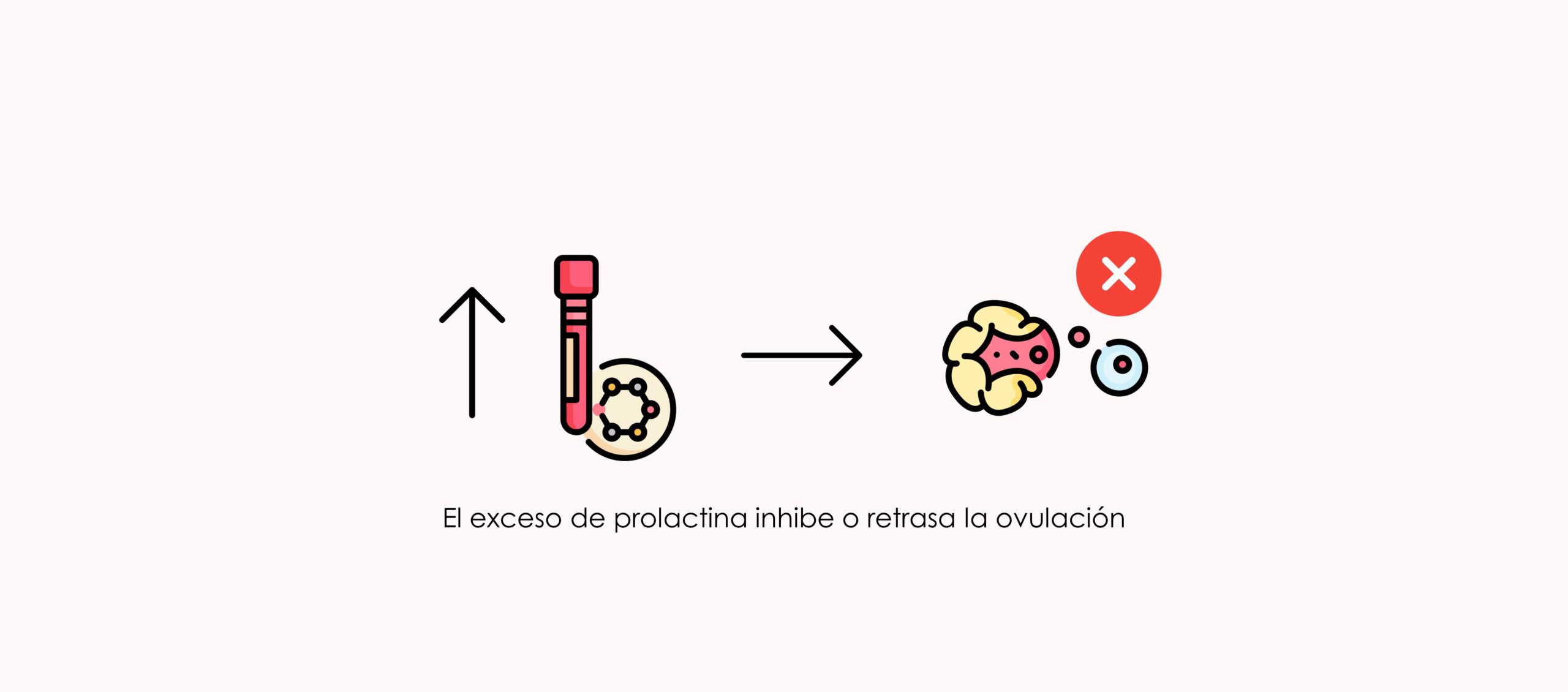 Hiperprolactinemia y embarazo