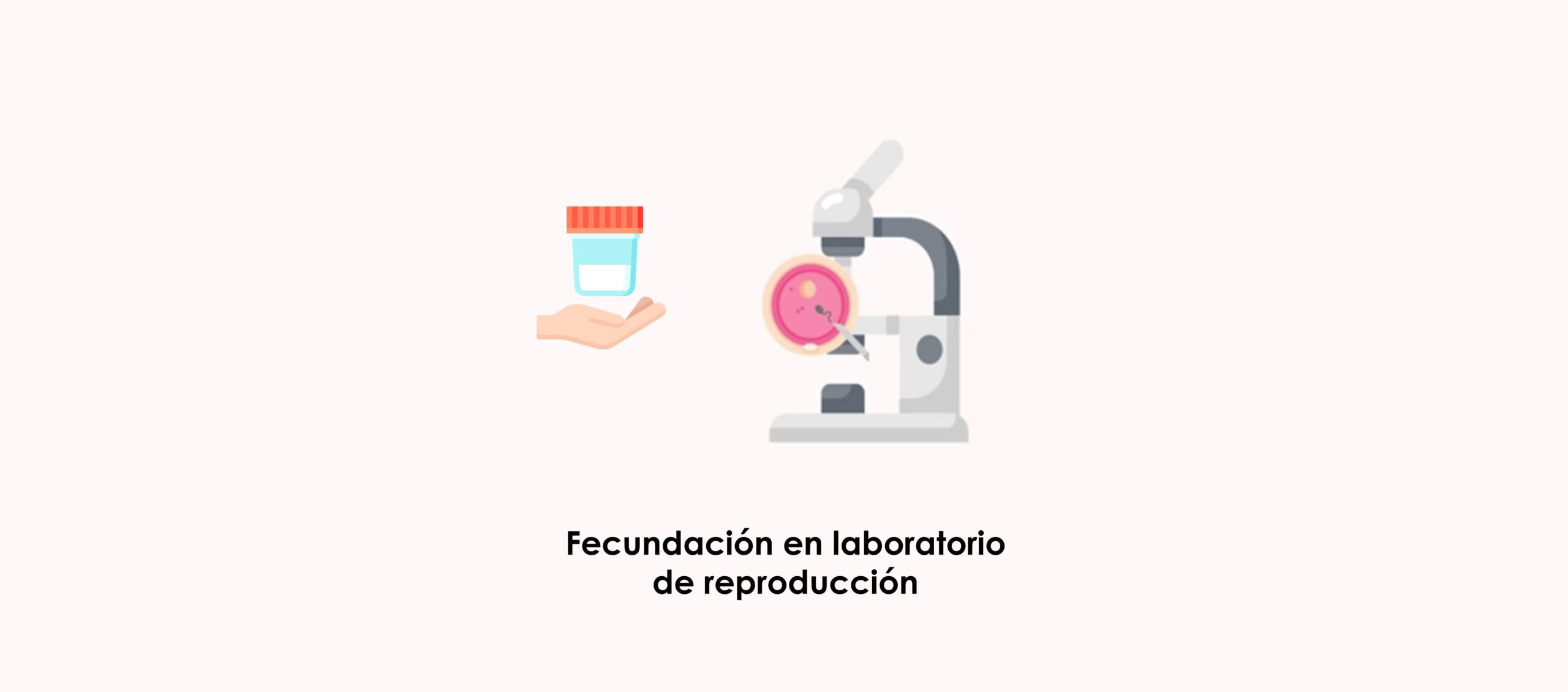 Fecundación in vitro con el semen de donante