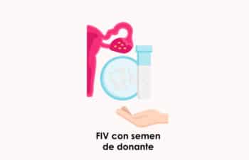 ¿Cómo es un embarazo por FIV con óvulos propios y semen de donante?