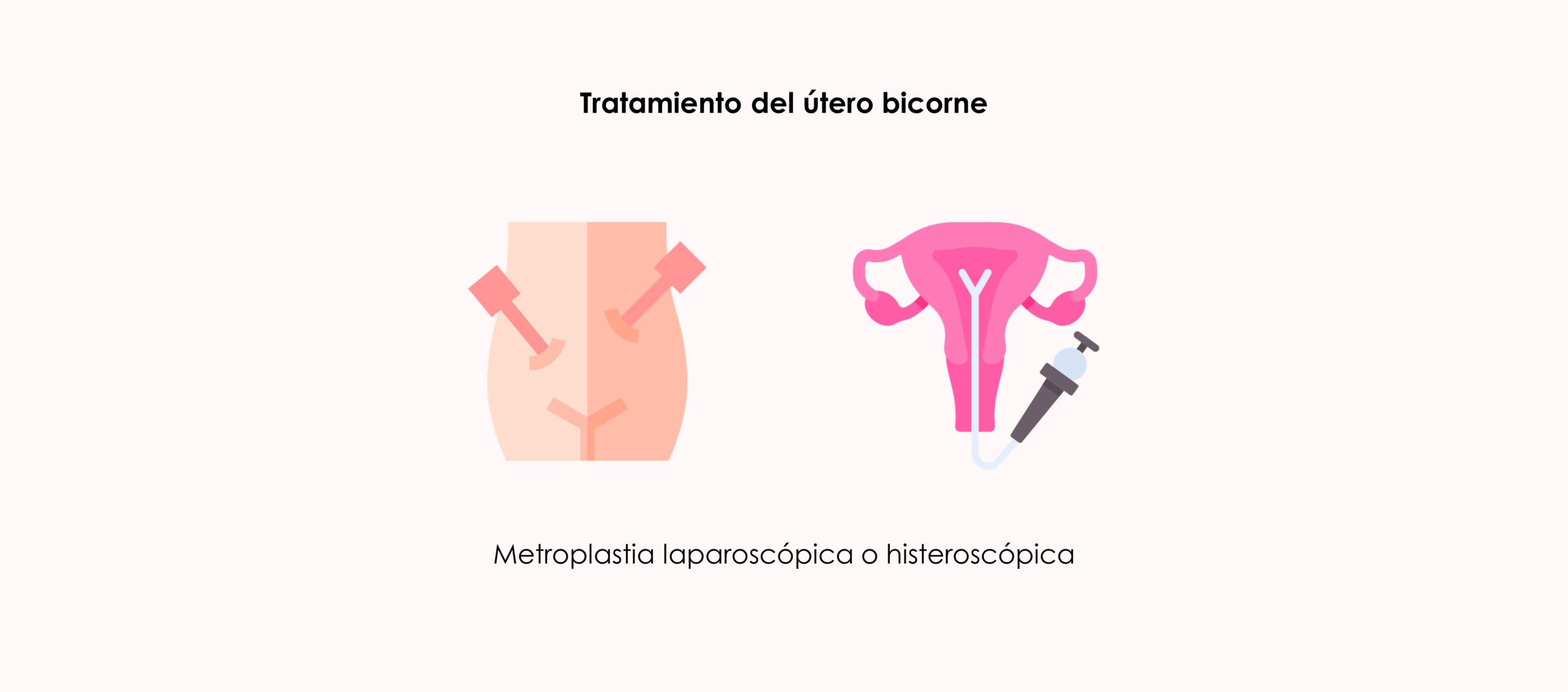 Útero bicorne, qué es y cómo influye en la fertilidad