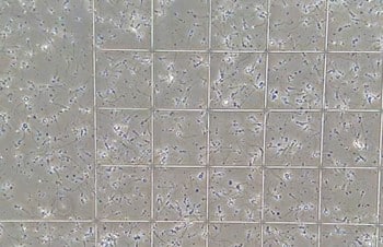 ¿Qué efecto tiene un elevado estrés oxidativo sobre la fertilidad?