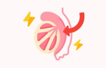 epididimitis y fertilidad masculina