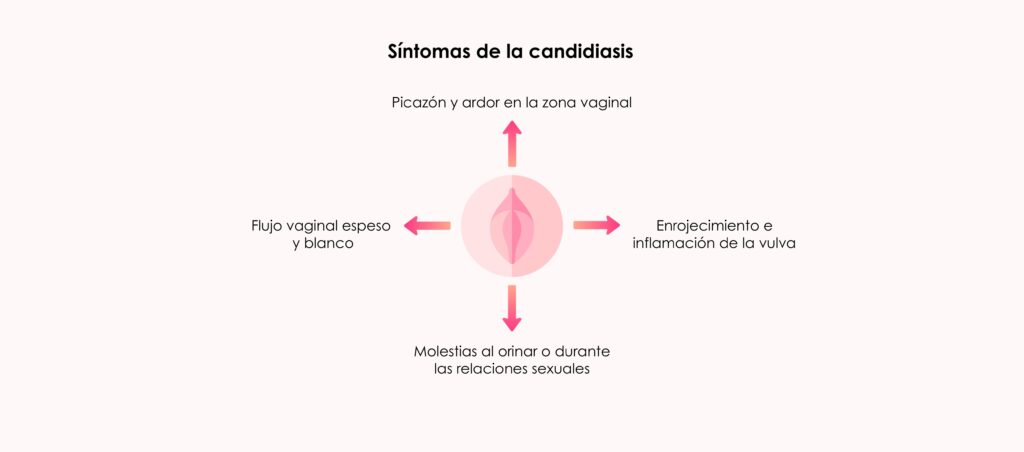 Síntomas de la candidiasis