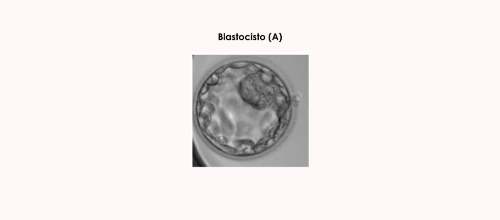 Blastocisto
