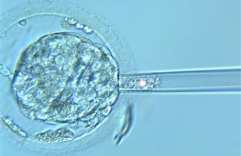 Biopsia embrionaria