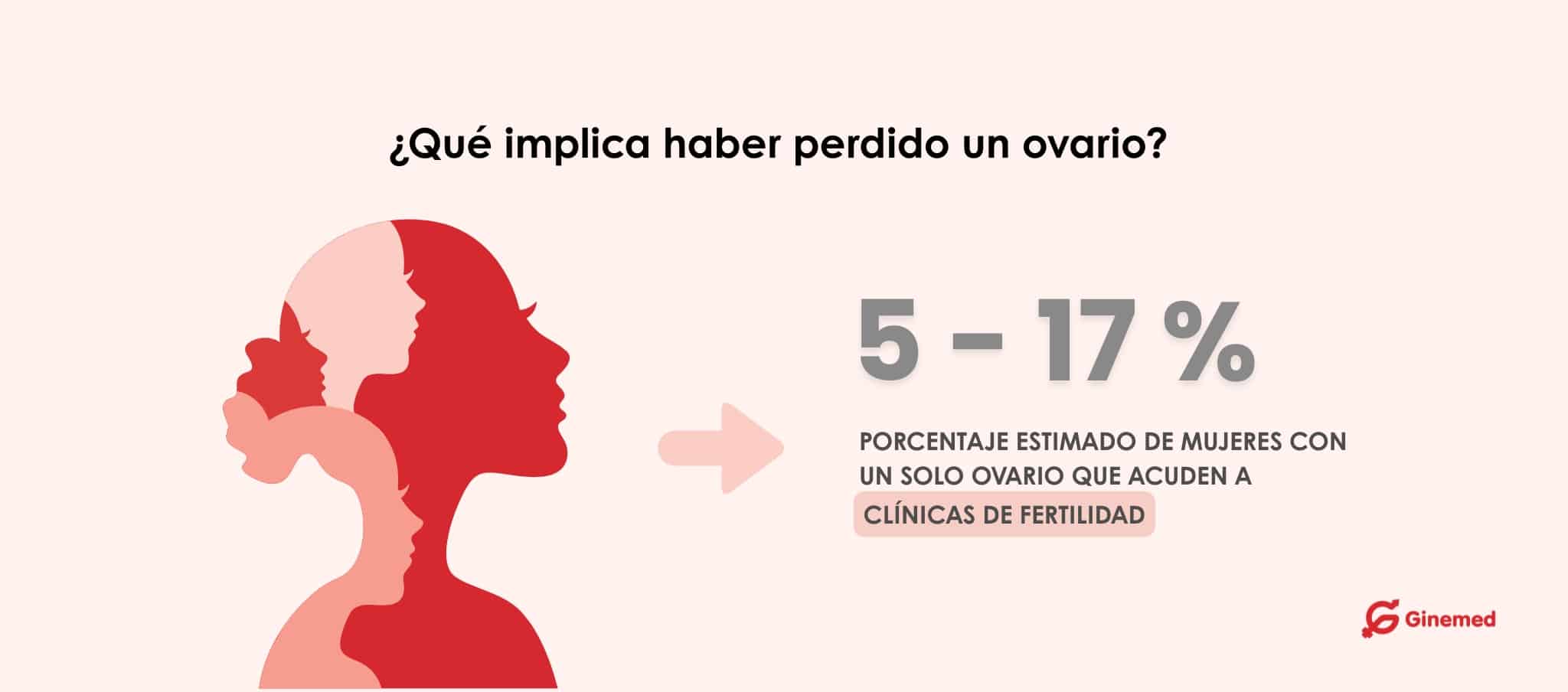 ¿Qué implica haber perdido un ovario?